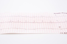 Kardiogramm Puls Spur