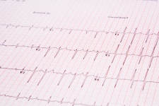 Kardiogramm Puls Spur