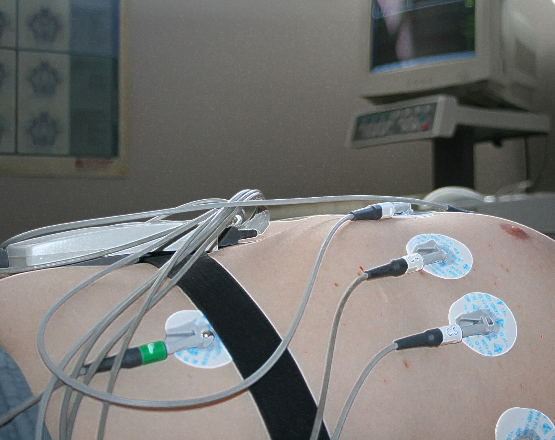 Electrodos de ECG conectados a torso