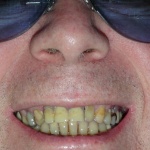 Los dientes de color amarillo
