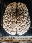 Mänsklig hjärna