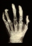 Medicina radiológica de mãos por raio-x
