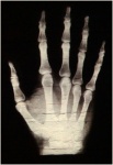 Medicina radiológica de mãos por raio-x