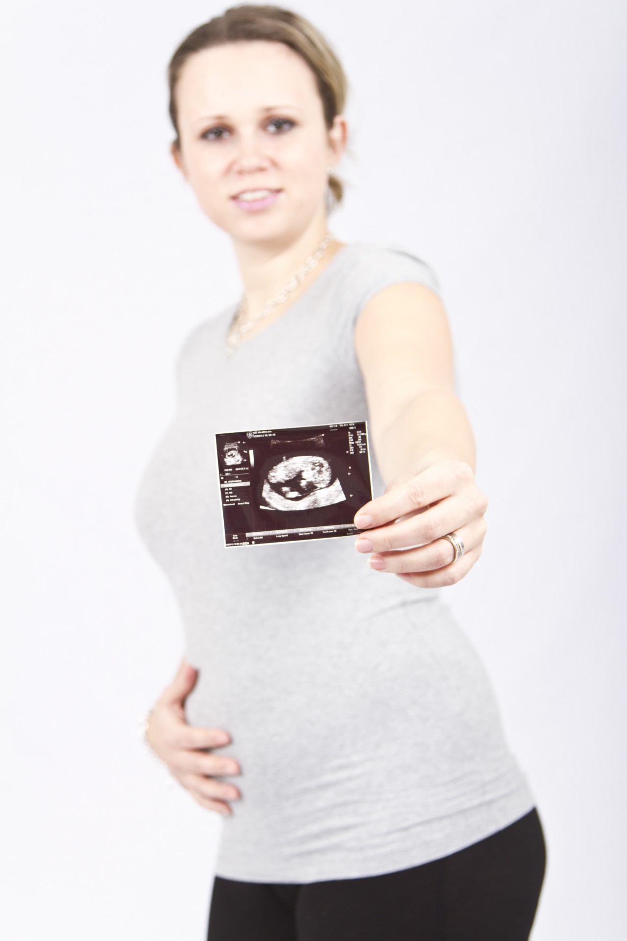 Schwangere Frau mit Scan-Bild